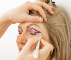 cirugía plástica facial en Monterrey